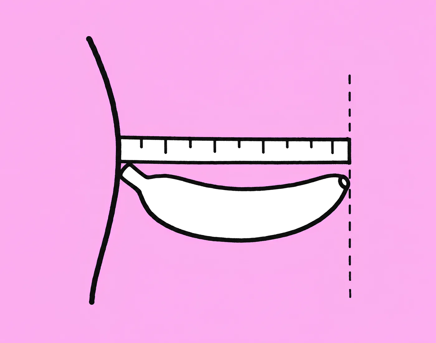 Bone-pressed erect penis length measurement: a rigid ruler placed on top of the shaft, pressed firmly against the pubic bone, read at the tip